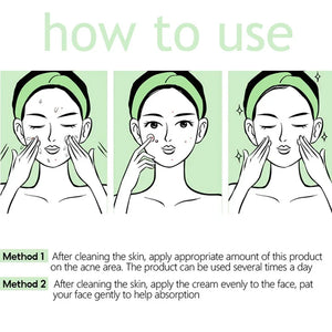 Acne Removal & Brightening Face Cream – Anti-Aging & Whitening