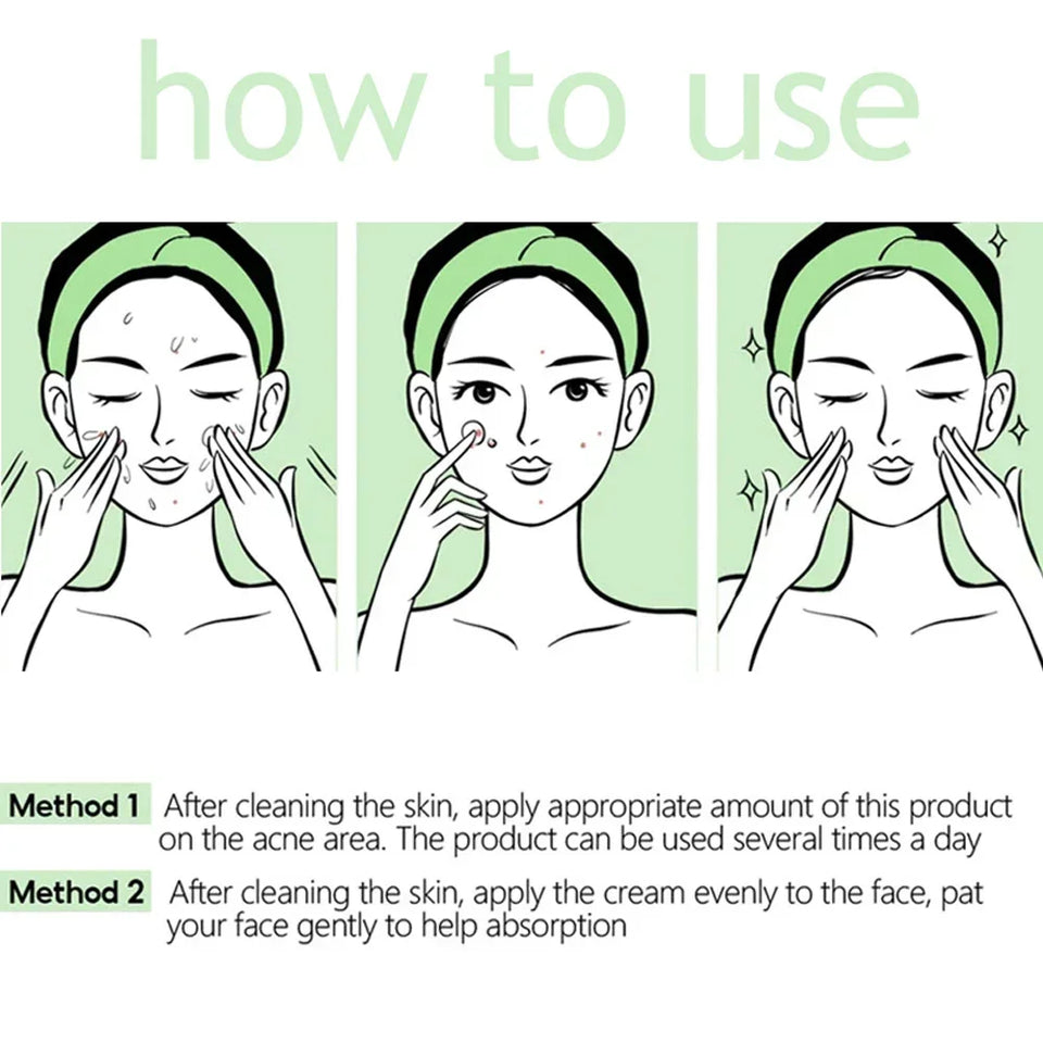 Acne Removal & Brightening Face Cream – Anti-Aging & Whitening