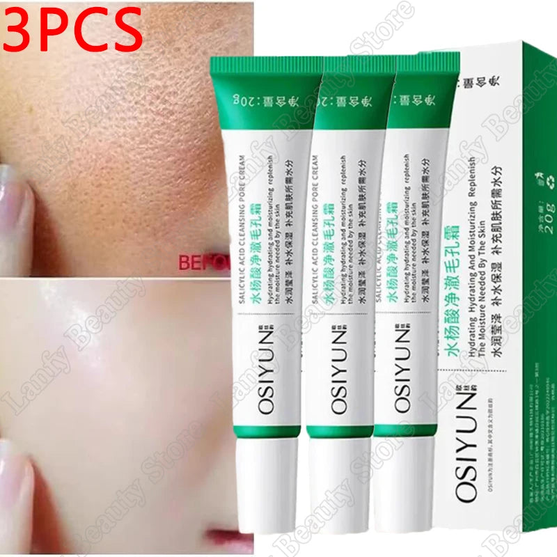Salicylic Acid Pore Refining Face Cream – 20g