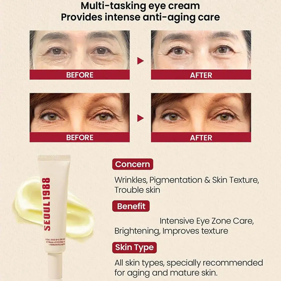Retinol Eye Cream for Dark Circles & Fine Lines – 30ml