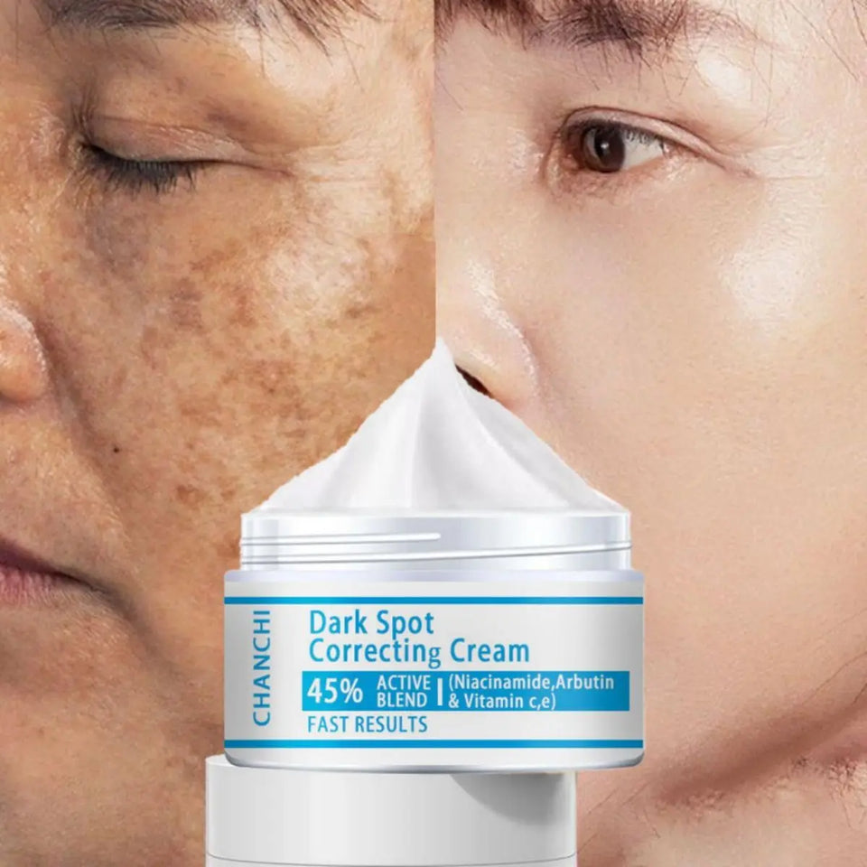 Dark Spot Corrector Face Cream – Anti-Aging, Whitening, Moisturizing