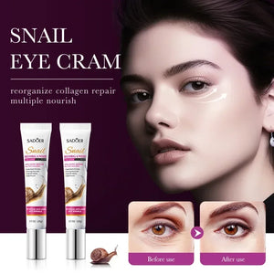 Snail Collagen Eye Cream – Anti-Aging & Moisturizing (20g)