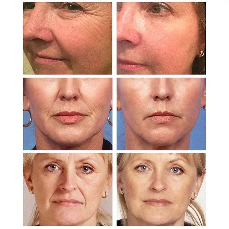 Instant Wrinkle Removal Serum – Firming, Lifting & Anti-Aging Face Care 30ml
