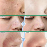 Salicylic Acid Pore Refining Face Cream – 20g