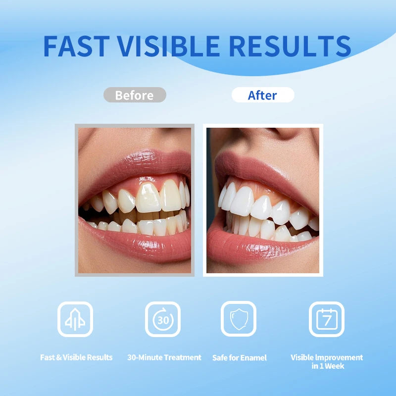 PAP Teeth Whitening Strips – 7 Day Result