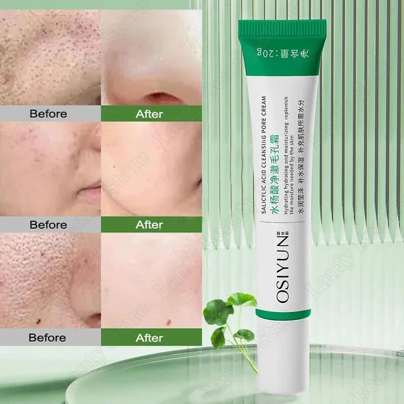 Salicylic Acid Pore Refining Face Cream – 20g