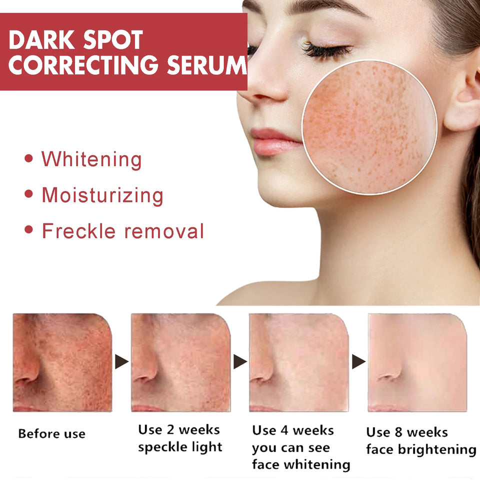 Niacinamide Dark Spot Correcting Serum – 30ml