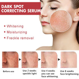 Niacinamide Dark Spot Correcting Serum – 30ml