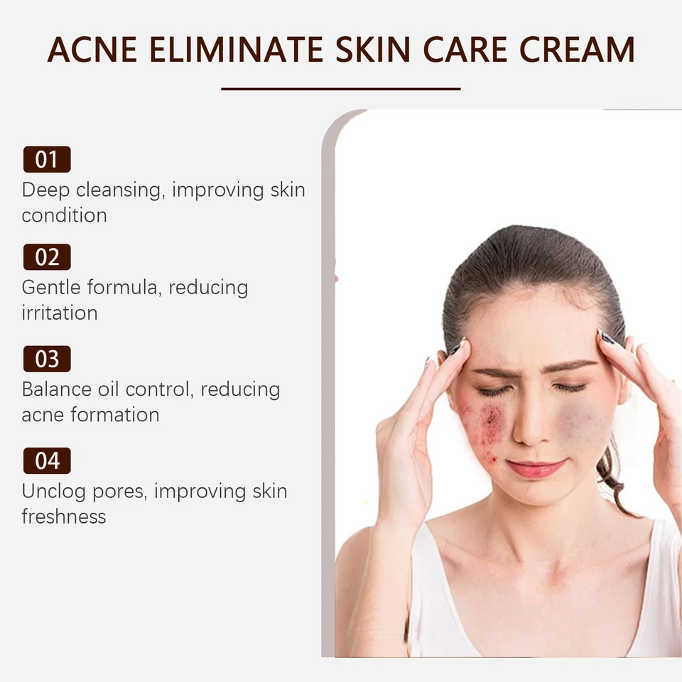 Acne Removal & Brightening Face Cream – Anti-Aging & Whitening