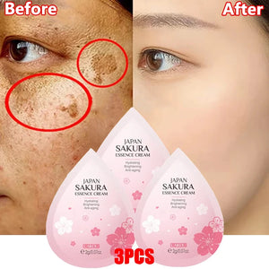 Niacinamide Dark Spot Correcting Cream – Brightening & Freckle Removal 20g