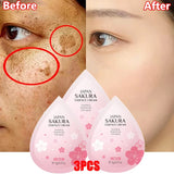 Niacinamide Dark Spot Correcting Cream – Brightening & Freckle Removal 20g