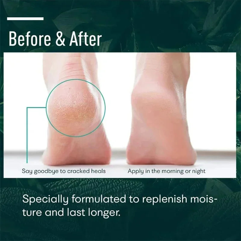 Cracked Heel Repair & Foot Moisturizing Cream – 50g