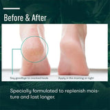 Cracked Heel Repair & Foot Moisturizing Cream – 50g