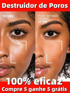 Pore Shrinking Face Cream with Lactobionic Acid – Oil Control & Skin Firming