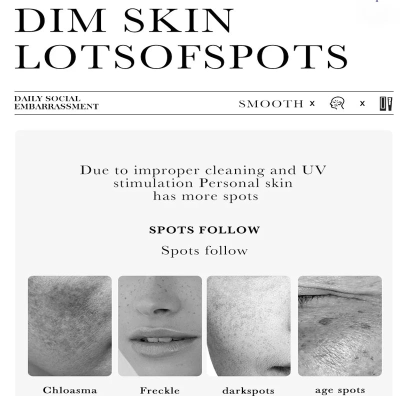 Dark Spot Correcting Cream – Freckle & Pigment Remover, 50ml