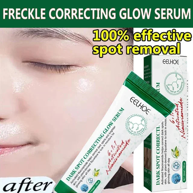 Dark Spot Remover & Freckle Whitening Serum