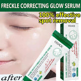 Dark Spot Remover & Freckle Whitening Serum