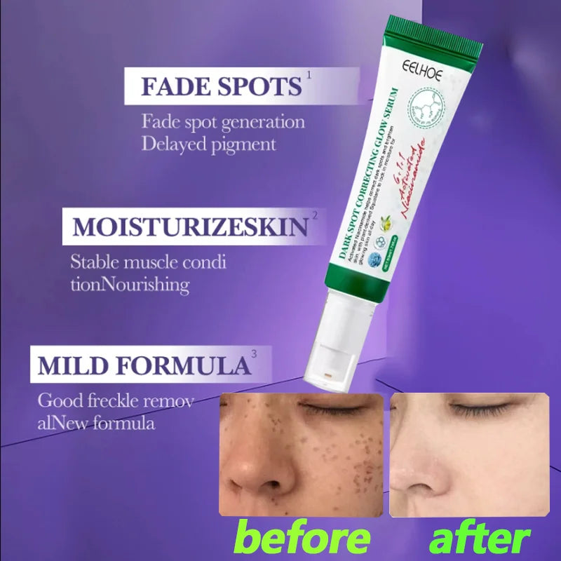 Dark Spot Correcting Cream – Freckle & Pigment Remover, 50ml
