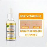 30X Vitamin C Face Serum – Brightening & Acne Mark Fading Essence