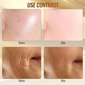 6-in-1 High Frequency RF Beauty Device – Acne & Anti-Aging Skin Care
