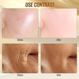 6-in-1 High Frequency RF Beauty Device – Acne & Anti-Aging Skin Care