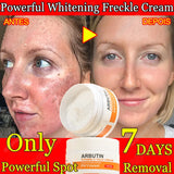 Dark Spot Remover & Whitening Face Cream – Vitamin C Brightening