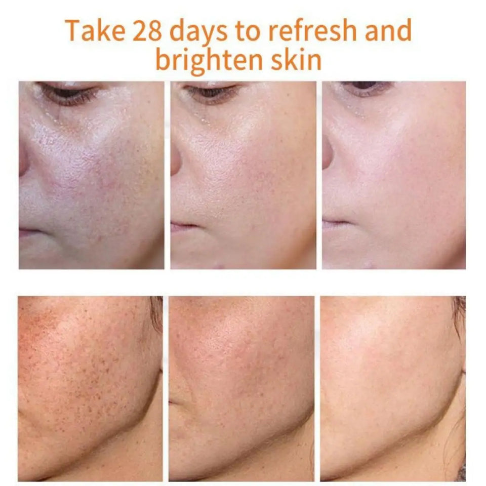Dark Spot Corrector Face Cream – Anti-Aging, Whitening, Moisturizing