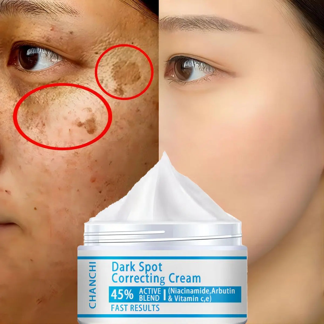 Dark Spot Corrector Face Cream – Anti-Aging, Whitening, Moisturizing