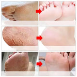 Cracked Heel Repair Foot Cream Spray – Exfoliating & Moisturizing 100ml