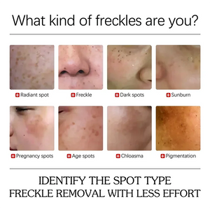 Dark Spot Correcting Cream – Freckle & Pigment Remover, 50ml