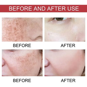 Niacinamide Dark Spot Correcting Serum – 30ml