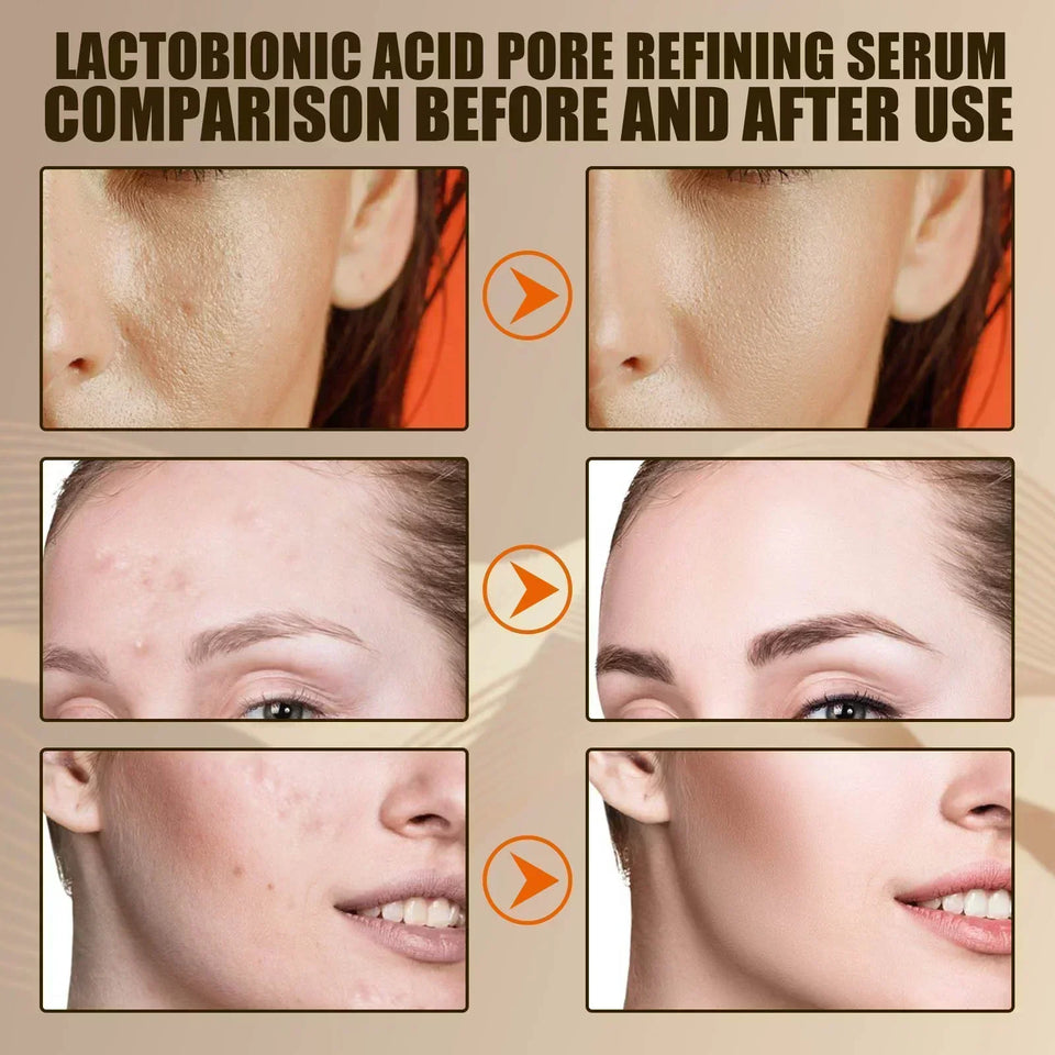 Pore Shrinking Face Cream with Lactobionic Acid – Oil Control & Skin Firming