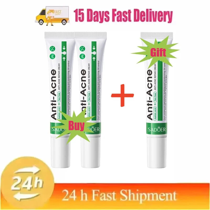 Salicylic Acid Acne Treatment Cream – Anti-Pimple & Oil Control
