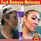 Brightening Freckle Removal Face Serum – Whitening & Hydrating
