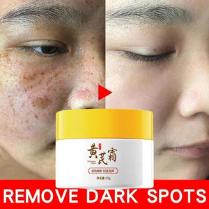 Astragalus Freckle Cream – Dark Spot Remover & Brightening (55g)