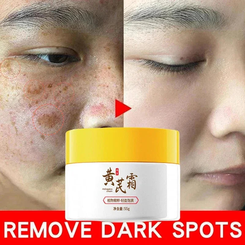 Astragalus Freckle Cream – Dark Spot Remover & Brightening (55g)