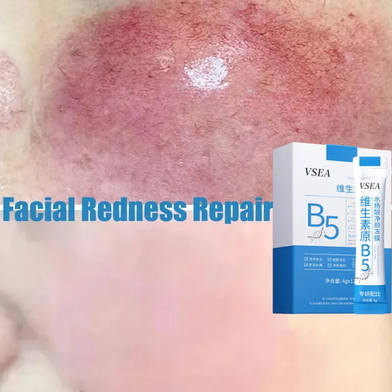 B5 Facial Redness Repair Cream for Sensitive & Acne-Prone Skin – Hydrating & Calming