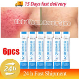 B5 Facial Redness Repair Cream for Sensitive & Acne-Prone Skin – Hydrating & Calming