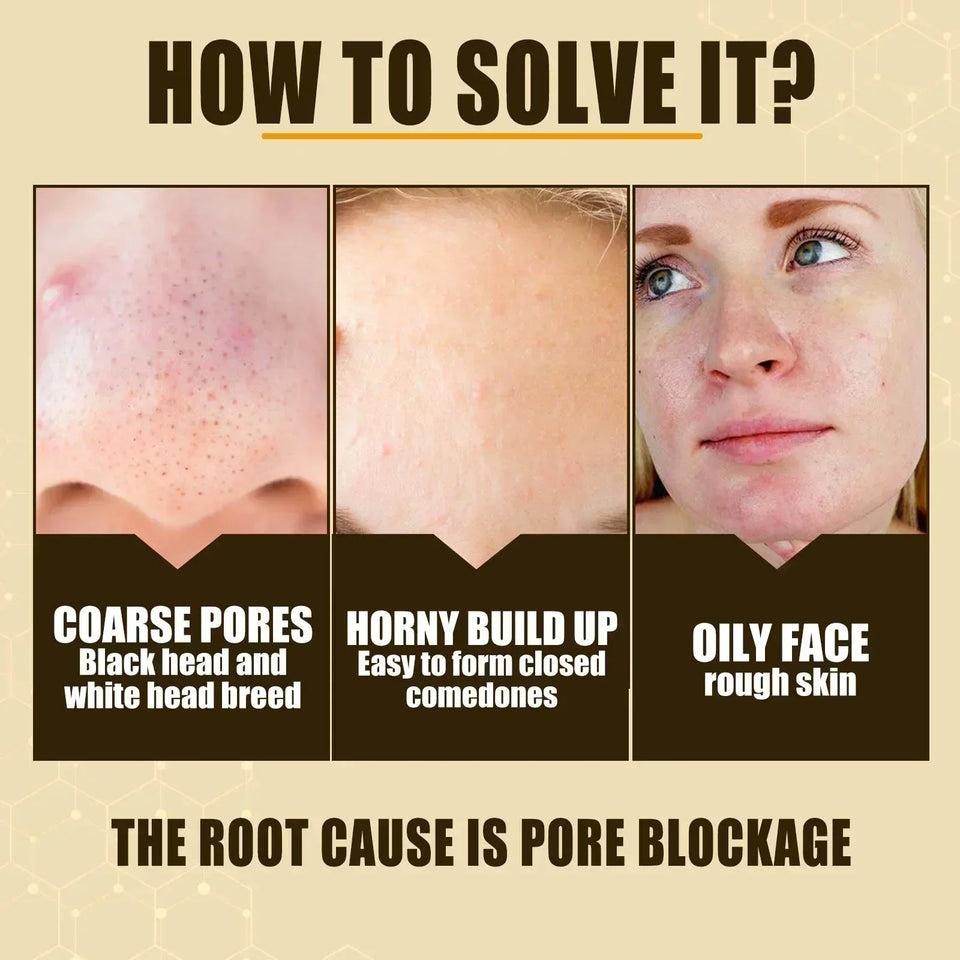 Pore Shrinking Face Cream with Lactobionic Acid – Oil Control & Skin Firming