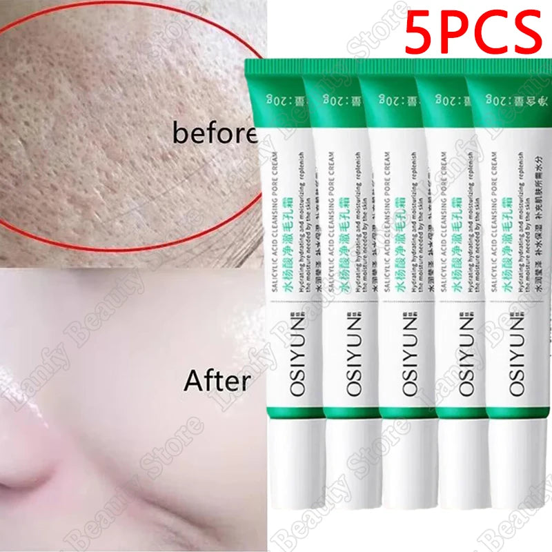 Salicylic Acid Pore Refining Face Cream – 20g