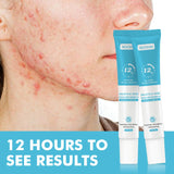 Anti-Acne Cream with Salicylic Acid – Clear Skin & Pore Refining