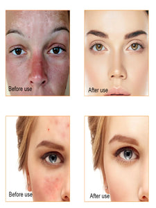Vitamin C Brightening Face Serum – Hydrating & Skin Repair Essence