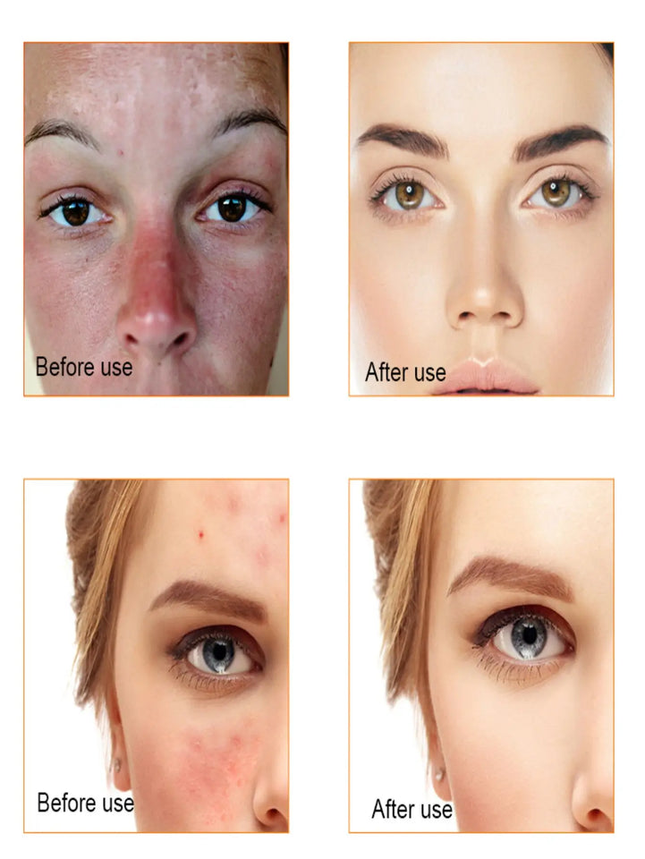 Vitamin C Brightening Face Serum – Hydrating & Skin Repair Essence