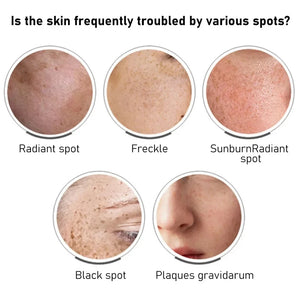 Dark Spot Remover & Freckle Whitening Serum