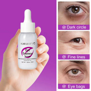 Anti-Dark Circle Eye Serum – Puffiness & Fine Line Treatment