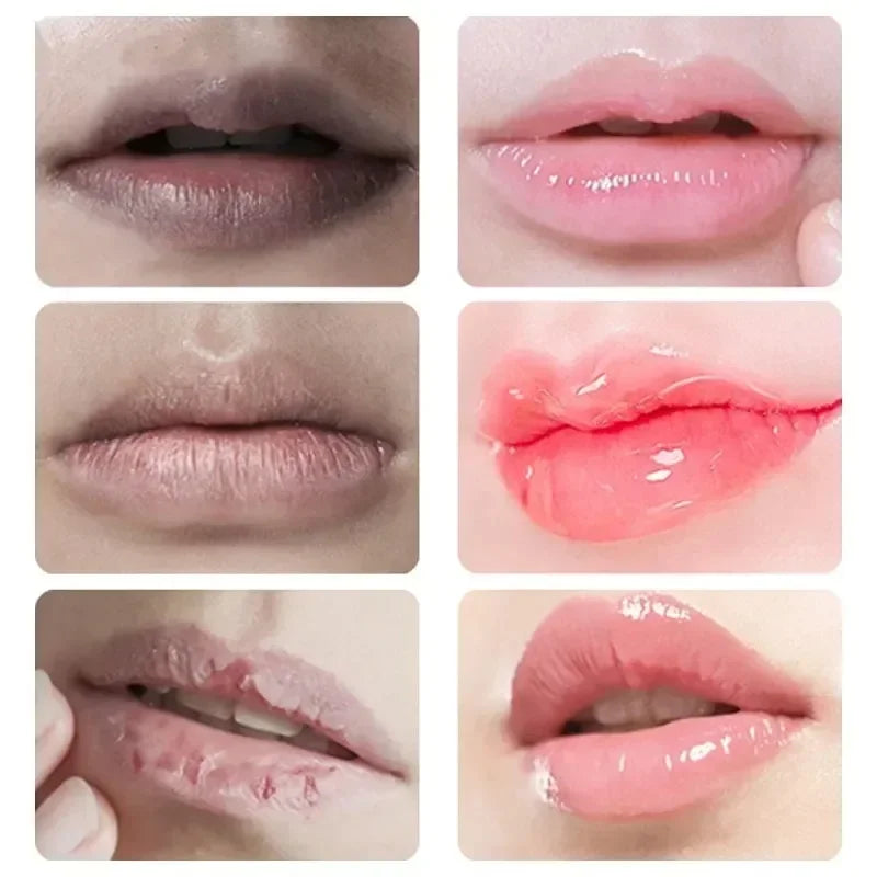 Hydrating Lip Balm – Moisturizing & Nourishing, 7g
