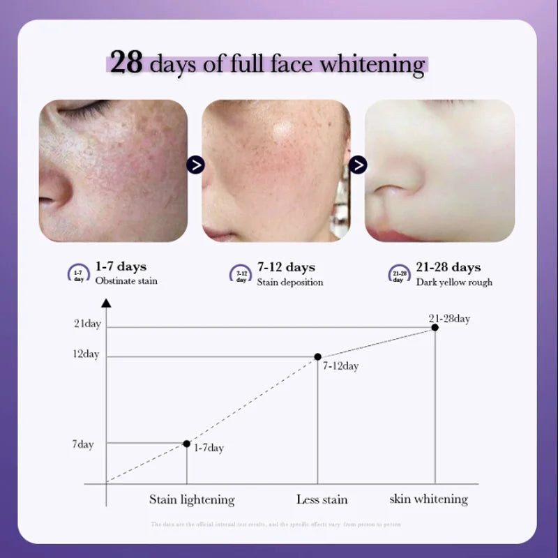 Dark Spot Correcting Cream – Freckle & Pigment Remover, 50ml
