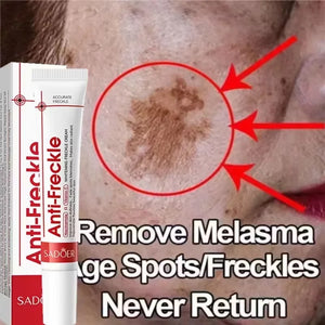 Niacinamide Dark Spot Correcting Cream – Brightening & Freckle Removal 20g
