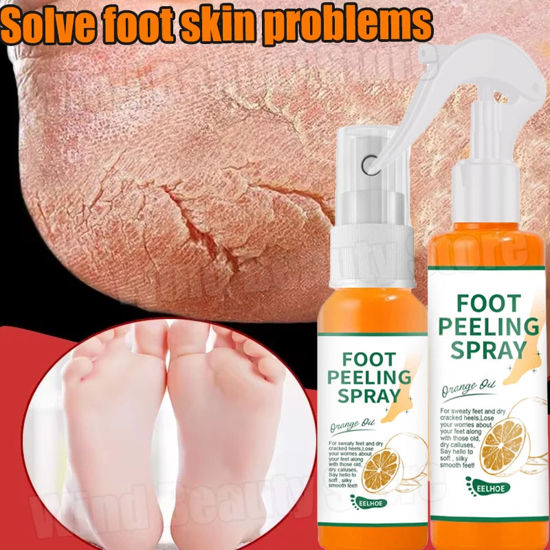 Cracked Heel Repair Foot Cream Spray – Exfoliating & Moisturizing 100ml