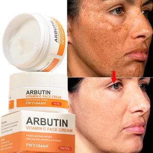 Dark Spot Remover & Whitening Face Cream – Vitamin C Brightening